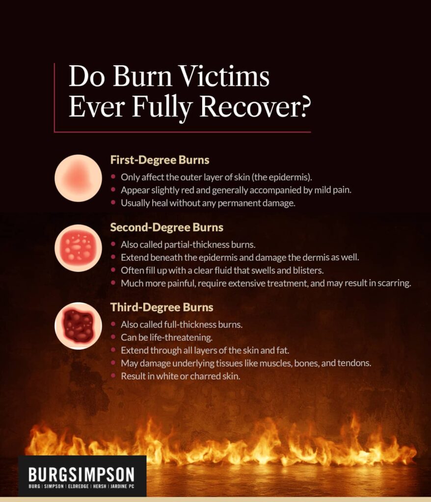 Do burn victims ever fully recover? | Burg Simpson