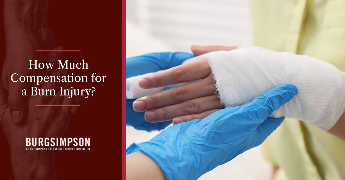 Burn Injury Compensation: How Much Are Burn Claims Worth?