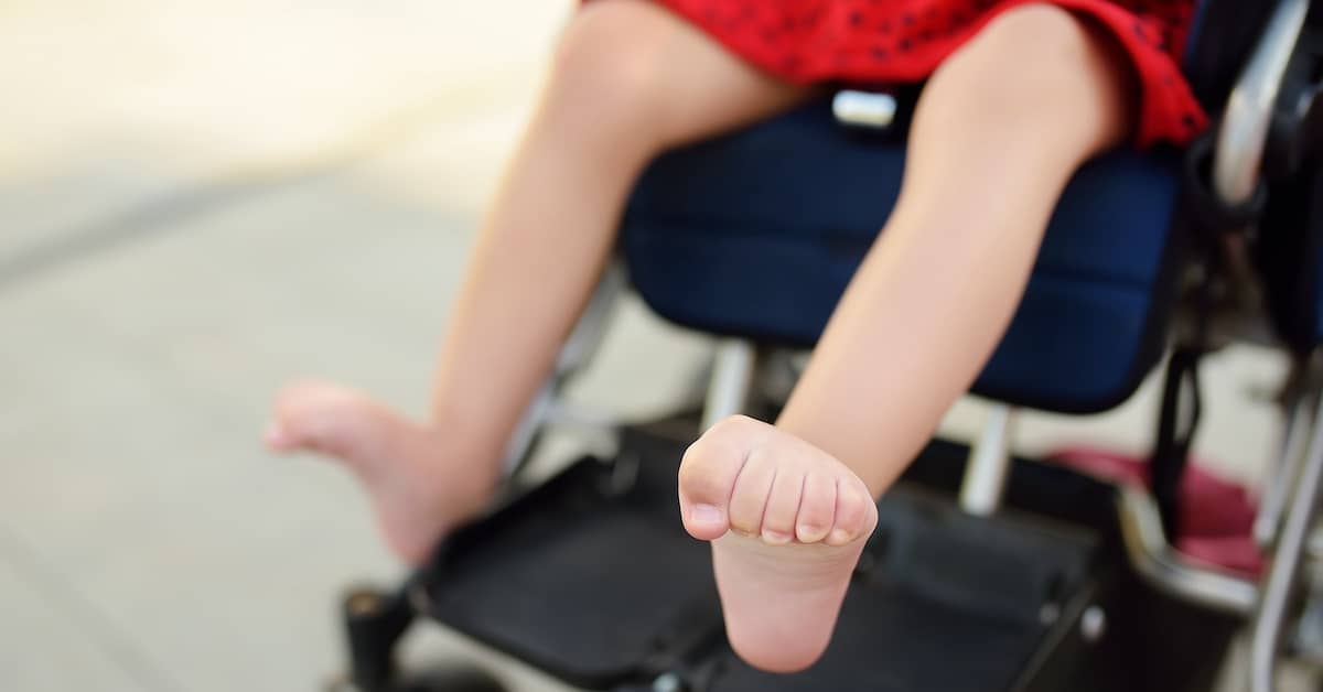 Girl with cerebral palsy sitting in a wheelchair | Burg Simpson