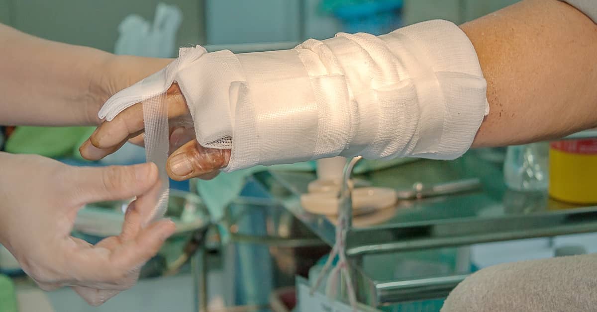 Patient receiving treatment for burn injury to the hand | Burg Simpson