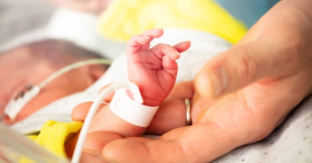 Newborn baby undergoing neonatal cooling | Burg Simpson