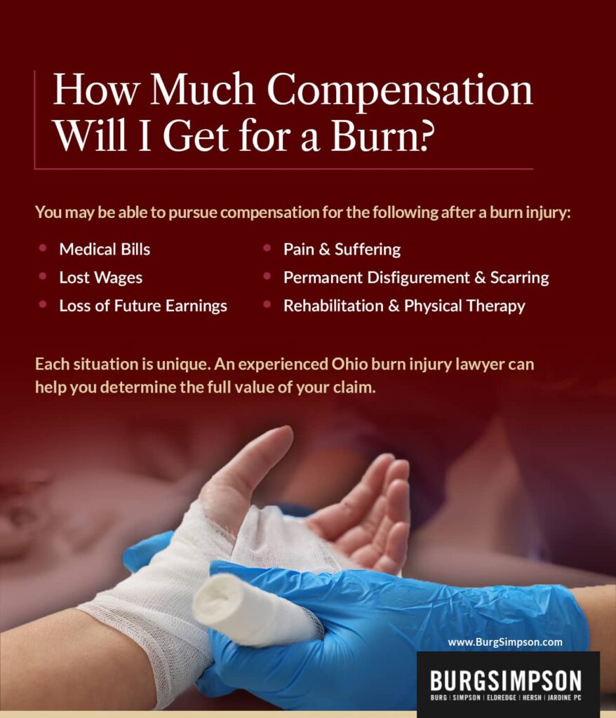 How much compensation will I get for a burn? | Burg Simpson